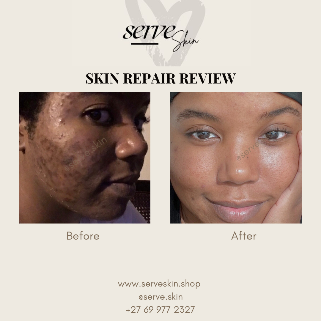 Repair & Plump SPF30 Face Moisturizer